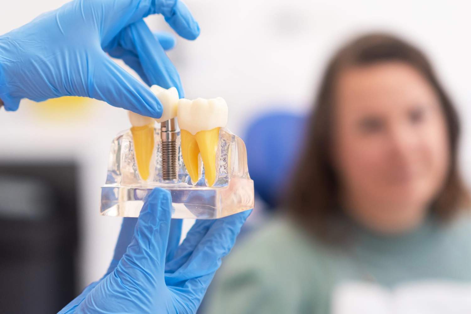 Implantes dentales: cuándo merecen la pena y qué debes saber antes de empezar el tratamiento