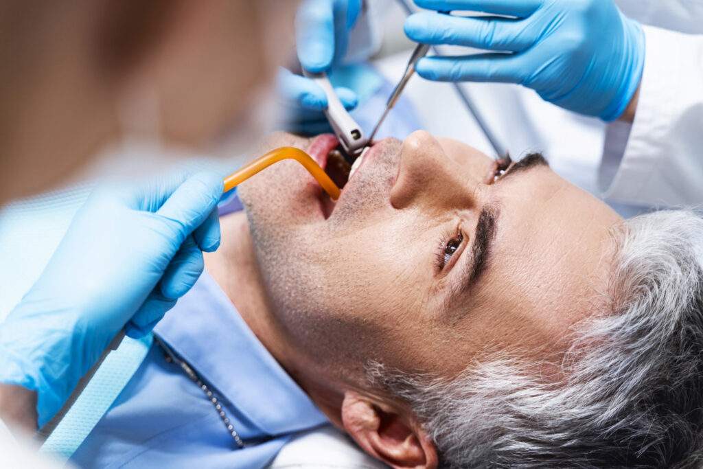 Injerto óseo dental: cuándo es necesario y por qué puede ser clave antes de colocar implantes